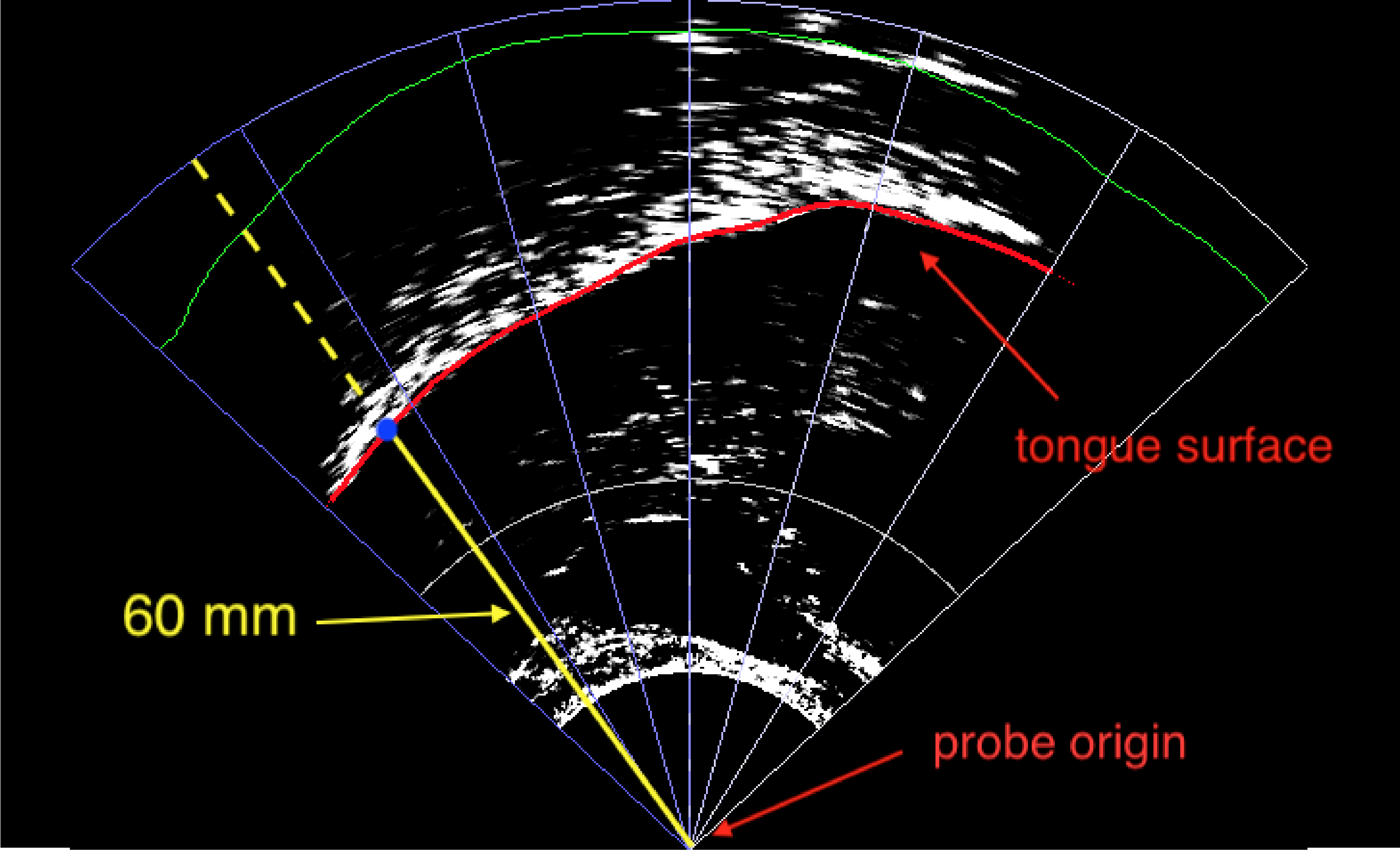 Schematics of the operationalisation of tongue root position, based on @kirkham2017. The tongue root surface corresponds to the lower edge of the white band in the image. The tongue tip is on the right side. The outline of the fan-like coordinate systems is shown. The yellow line starting from the probe origin is the selected fan-line from which tongue root position is calculated (see text for the method of fan-line selection). Tongue root position thus corresponds to the distance (in millimetres) between the probe origin and the intersecting point of the tongue surface with the selected fan-line.